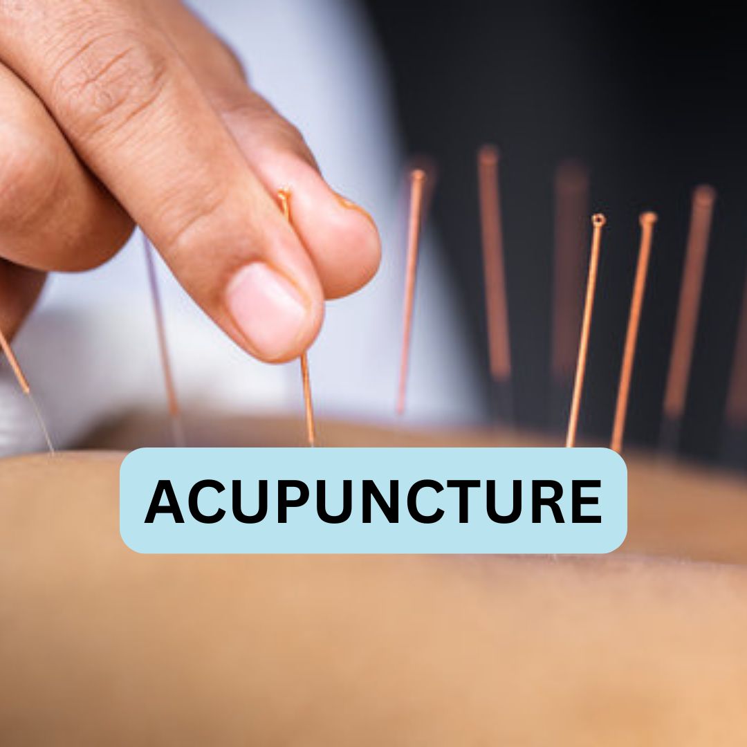 Chande Jigna - Acupuncture